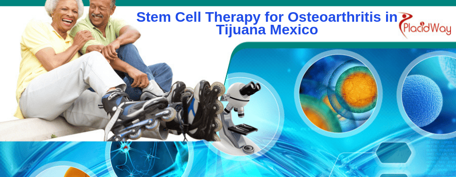 Stem Cell Therapy for Osteoarthritis in Tijuana Mexico